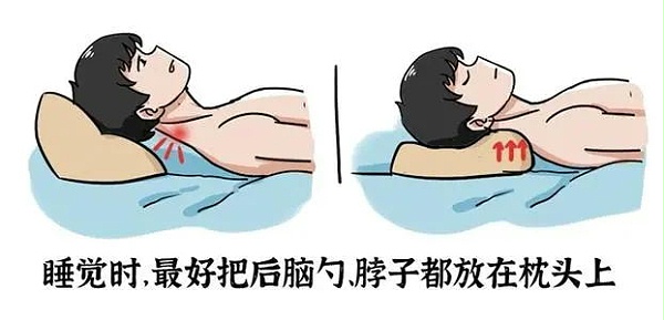 颈椎睡眠